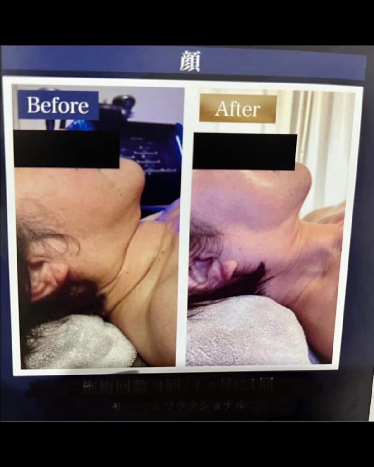 multi_image